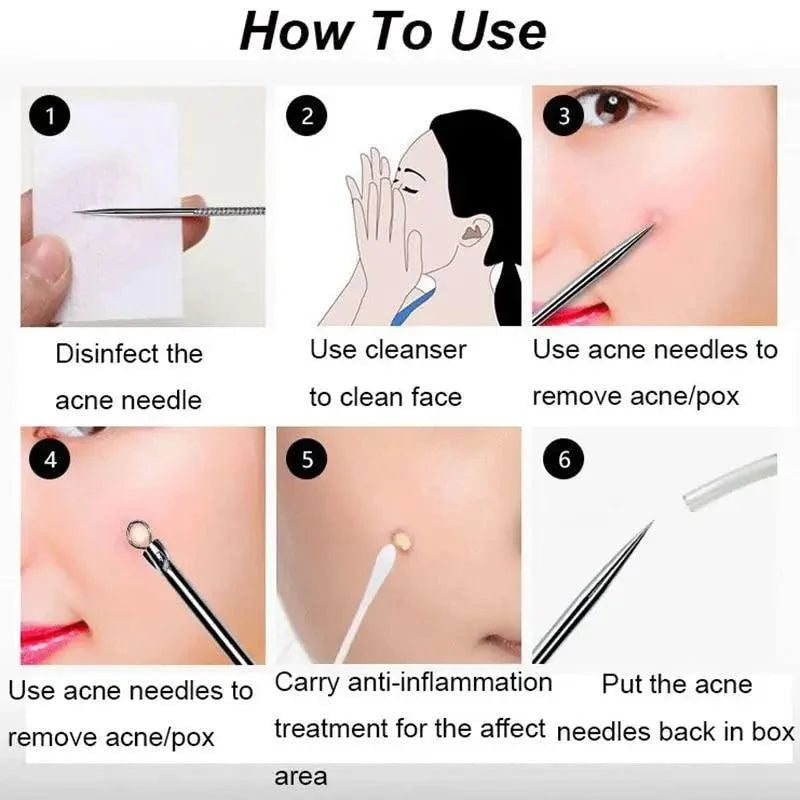Acne Removal Tools Pimple Blackhead Remover Facial Pore Cleaner Stainless Steel with case - Skin Care tools
